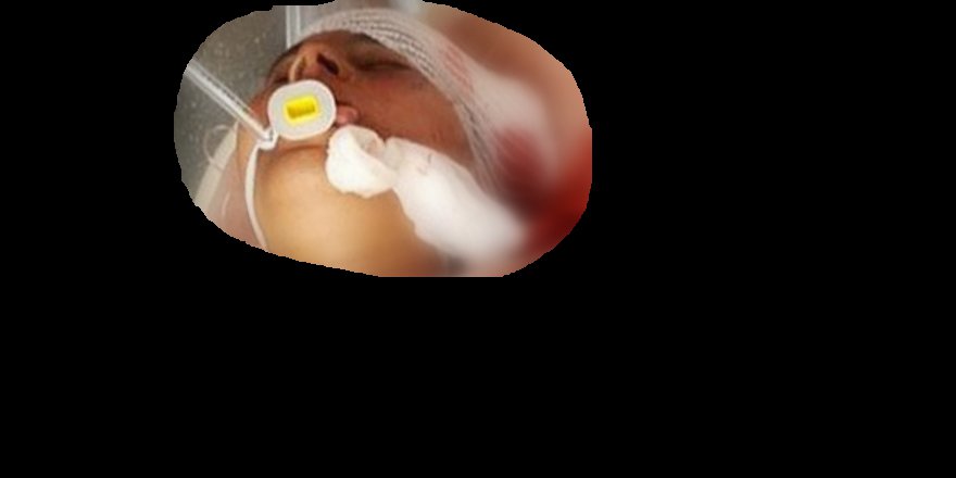 PKK/PYD Suriye’de Sivil Kadına Saldırdı!