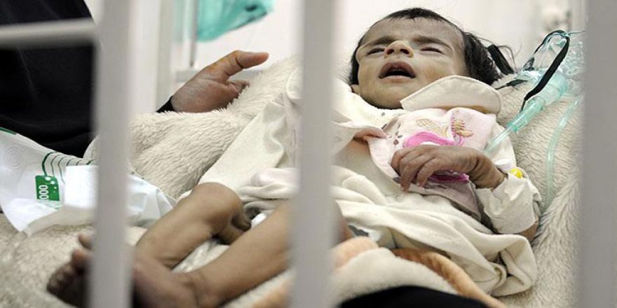 Yemen'deki Kolera Salgınında Ölü Sayısı 800'e Yaklaştı