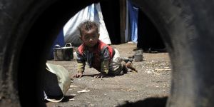 “Yemen’de 7 Milyon Kişi Açlık Tehlikesiyle Karşı Karşıya”
