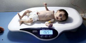 Gıdasızlıktan Ölen Suriyeli Bebeğin Son Anları!