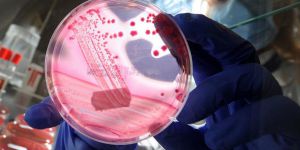 DNA'daki Genomlarda Değişiklik Yapmayı Kolaylaştıran Enzim Keşfedildi