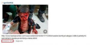 Yaralı Çocuk Fotoğrafı Üzerinden Kara Propaganda Başlatıldı