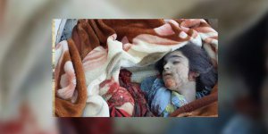 Esed ve Destekçileri Yine Çocukları Vurdu!