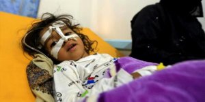 Yemen'de Kolera Salgınından Ölenlerin Sayısı 190'a Yükseldi