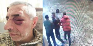 70’lik Dedeyi Bu Hale Getiren Vandallar ‘Sarhoştular’ Denilerek Cezasız Kalmasınlar!