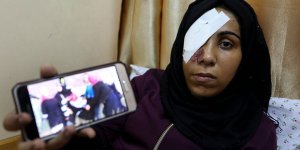 Filistinli Genç Kız Büyük Dönüş Yürüyüşü Gösterilerinde Gözünü Kaybetti 