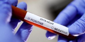 İtalya Sağlık Bakanı: Koronavirüsü İzole Ettik