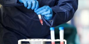 Türkiye’de Koronavirüs Vaka Sayısı 86 Bin 306’ya, Can Kaybı 2017’ye Çıktı