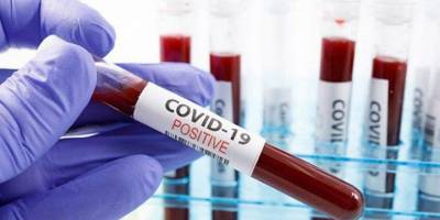 Dünya Genelinde Yeni Tip Koronavirüs Vaka Sayısı 7 Milyonu Aştı