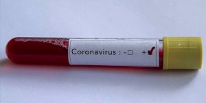 Koronavirüs Türkiye’de 10.027 can aldı