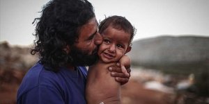Uzuvları olmayan İdlibli Muhammed bebeğe yardım eli