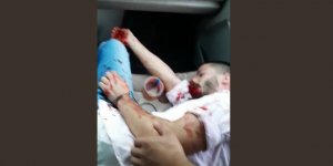 Bu ırkçılık virüsüne kim dur diyecek!