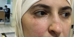Gaziantep’te Suriyeli kadına ırkçı saldırı