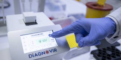 Koronavirüs teşhisini 10 saniyeye düşüren tanı sistemi geliştirildi