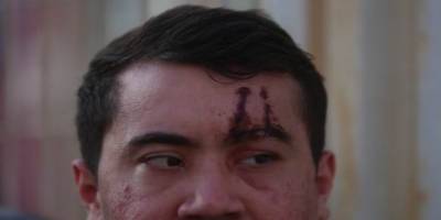 Polis olmasaydı linç edilecektik