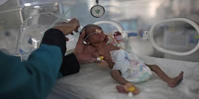 BM: Yemen'de 2 milyondan fazla çocuk açlığın pençesinde