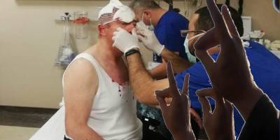 Milliyetçilerin söyleyecek sözü olmayınca!