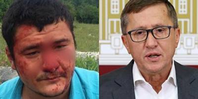 Saldırgan İYİ Partili Türkkan'ın yeğeni çıktı