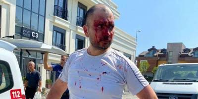 Türkmen diktası İstanbul’da bu zorbalığa nasıl cesaret bulabiliyor?