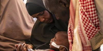 Somali'de hastaneler açlıktan ölüme sürüklenen çocuklarla dolu