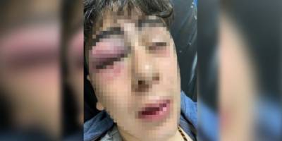 Diyarbakır'da '14 yaşındaki çocuğa işkence' iddiasıyla ilgili 5 polis gözaltına alındı