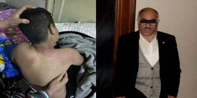 10 yaşındaki bir çocuğa saldıranlar hesap vermeyecek mi?