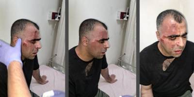 Tatvan Özgür-Der Şubesi gazeteci Sinan Aygül'e yapılan saldırıyı kınadı