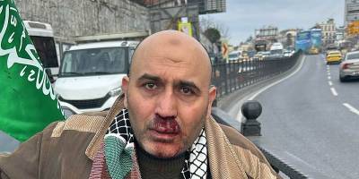 Galata köprüsündeki büyük mitingden dönen vatandaşa ırkçı saldırı