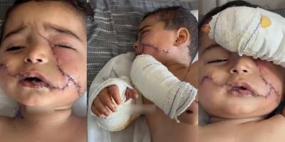 Gazzeli minik bebeğe 200 dikiş atıldı