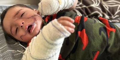 Filistinli bebek Al-Arabi, yaşam mücadelesi veriyor
