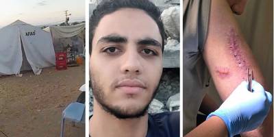 Şarapnel sağ elimdeki tüm tendonları kopardı