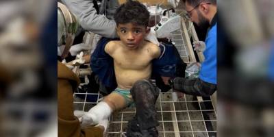 Siyonist rejim bir çocuğu daha uzvundan etti!
