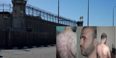 “İsrailli sorgucular işkence sırasında üzerime asit döktüler”