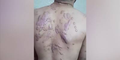 Filistinli Ebu Tavile, Siyonistlerin işkenceleri sonucu gözünü kaybetti