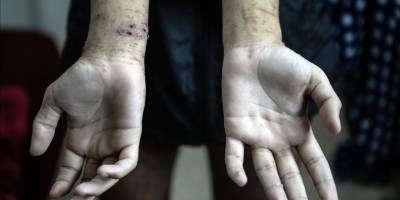 Gazzeli tutuklular en korkunç koşullara maruz kalıyor  