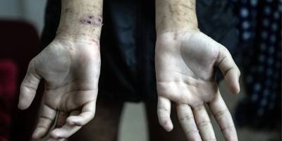 Gazzeli tutuklular korkunç koşullara maruz kalıyor