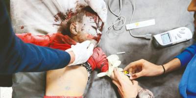 Gazze'de 10 günde 322 çocuk katledildi