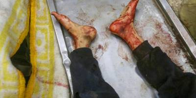 Gazze Şeridi'nde sadece 52 tane yoğun bakım yatağı kaldı