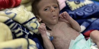 Gazze'de 70 bin çocuk şiddetli açlık çekiyor