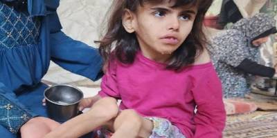 Gazze'deki Kıtlık ve İnsanlığımızın Erozyonu