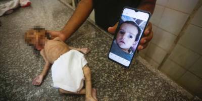 İsrail ablukası altındaki Gazze'de 3 aylık bebek Curi de açlıktan öldü