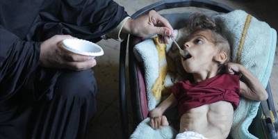 Gazze'de her gün yaklaşık 110 çocuk şiddetli açlık sebebiyle hastaneye kaldırılıyor