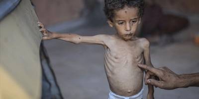 2 yaşındaki Ebu Ful hayati tehlikeyle karşı karşıya!