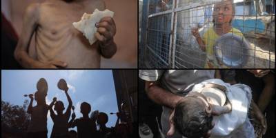 Soykırımcı İsrail saldırıları ve ablukası altındaki Gazze'de açlıktan çocuk ölümleri artıyor