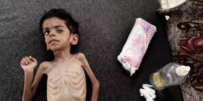 Gazze'de insanlar açlığa yenik düşüyor