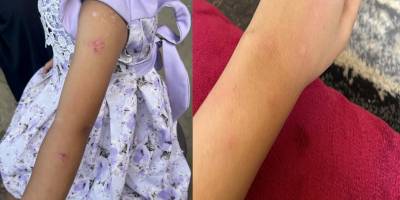 Kum ve deri arasında