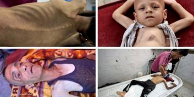 Gazze'de açlık nedeniyle toplu ölümler başladı