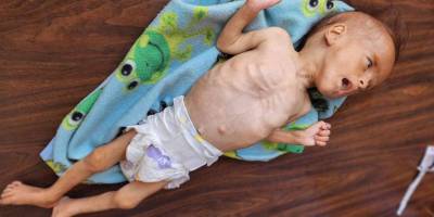 100'den fazla STK Gazze'de “toplu kıtlık” uyarısı yaptı