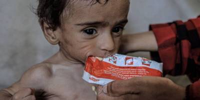 Siyonist abluka Gazze'de kitlesel açlığa yol açtı