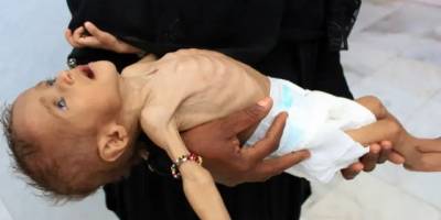 ABD ve İsrail’in ortak silahı: Aç bırakmak!